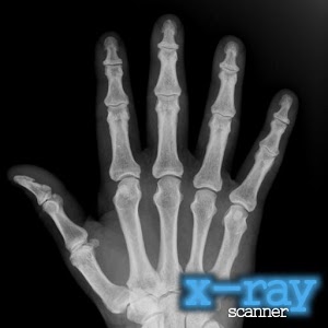 X-Ray Scanner v1.7.4