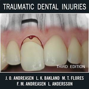 Traumatic Dental Injuries v2.3.1